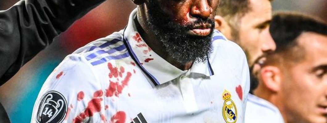 Verdedig de witte kleren met zijn leven!